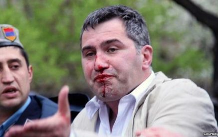 Արմեն Մարտիրոսյանը ծաղրում է իրեն հարվածող ոստիկաններին, որ լավ չեն կարողացել հարվածել