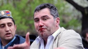 Ա. Մարտիրոսյան. Կարեւորը մեղադրյալ չդարձա