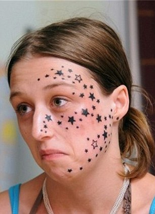 Daily Mail. «Թումանյանցի դաջած 56 աստղերը հեռացված են աղջկա երեսից»