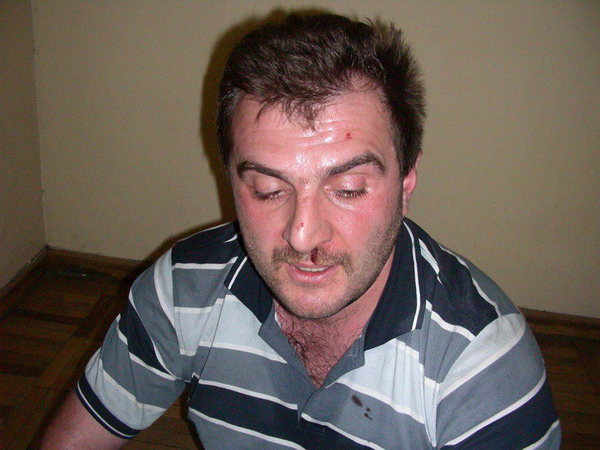 Ոստիկանները ծեծել են քաղաքացիական ակտիվիտ Արգիշտի Կիվիրյանին
