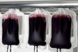 Ախտորոշումը ճշտելու նպատակով հիվանդը կկարողանա արտահանել իր արյունը և դրա բաղադրամասերը