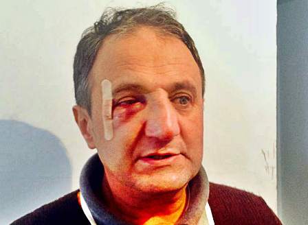 Գյումրիի ոստիկանները հայտնաբերել են գյումրեցի գրավաճառ Վազգեն Կարապետյանին ծեծի ենթարկողին
