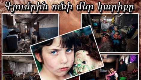 «SOS Գյումրին» 23 անօթեւան ընտանիքի բնակարանի հարց է լուծել. «Ա1+»