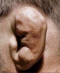«Ջարդված» ականջները՝ տղամարդկության եւ ուժի նշան