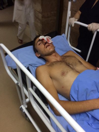 17-ամյա Սայաթ Հարությունյանի աչքը ոստիկանների արձակած լուսաձայնային նռնակներից, ճայթուկներից վնասվել է
