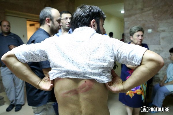 On the 13th day of the occupation of Patrol-Guard Service Regiment of Erebuni district by 'Sasna Tsrer' group, protesting people marched to Sari Tagh and clashed with the policemen. Injured were brought to the St. Grigor Illuminator Hospital in Yerevan, Armenia