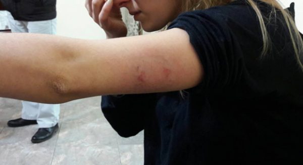 Միավորված ազգերի կազմակերպության հայաստանյան գրասենյակը խորապես դատապարտում է կանանց նկատմամբ բռնության վերջին դեպքերը Երևանում