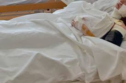 Երևանում ինքնասպանության փորձ է կատարել Ղրղզստանի Հանրապետության 29-ամյա քաղաքացին. shamshyan.com