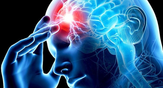 Պետական պատվերը գործում է գլխուղեղի իշեմիկ կաթվածի կլինիկական նշանների ի հայտ գալու պահից 24 ժամվա ընթացքում
