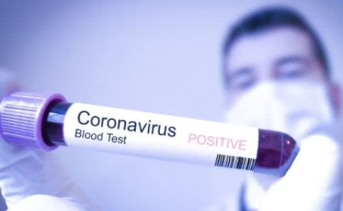 Արցախում կորոնավիրուսային հիվանդության 4 նոր դեպք է գրանցվել