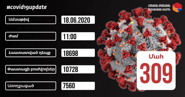 Հաստատվել է կորոնավիրուսային հիվանդության 665 նոր դեպք, արձանագրվել է մահվան 7 դեպք
