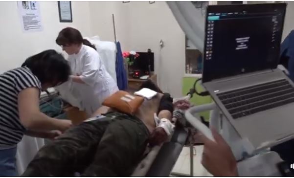 Արցախցի բժիշկներին հաջողվել է փրկել Մարտունիում ադրբեջանական հրետակոծությունից ծանր վիրավորված ֆրանսիացի լրագրողի կյանքը