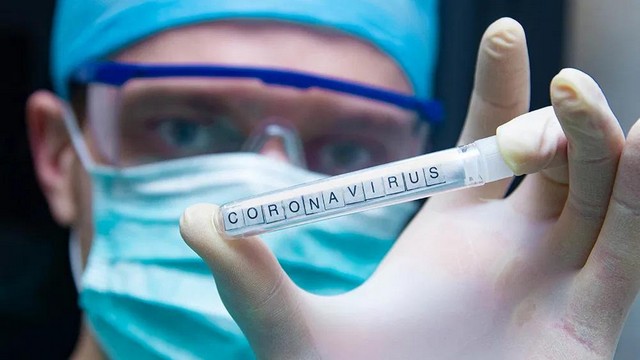 Արցախում կորոնավիրուսային հիվանդության 78 նոր դեպք է գրանցվել