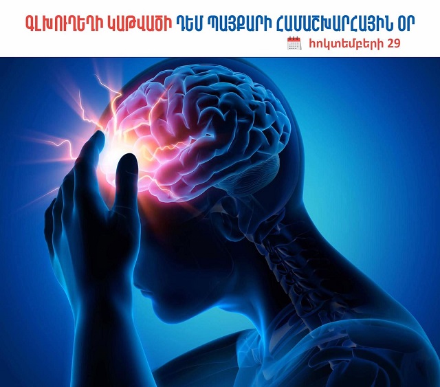 Կաթվածը մահվան և հաշմանդամության հանգեցնող հիմնական պատճառներից է․ ԱՆ