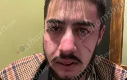 Ծեծի են ենթարկել 20-ամյա հայ տղային․ ըստ նրա՝ ծեծի ենթարկողը Արա Աբրահամյանի ներկայացուցիչն է․ Shamshyan.com