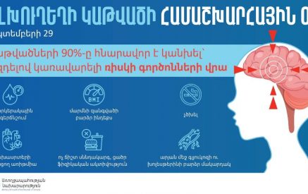 Կաթվածի զարգացման ամենամեծ ռիսկի գործոնը զարկերակային գերճնշումն է
